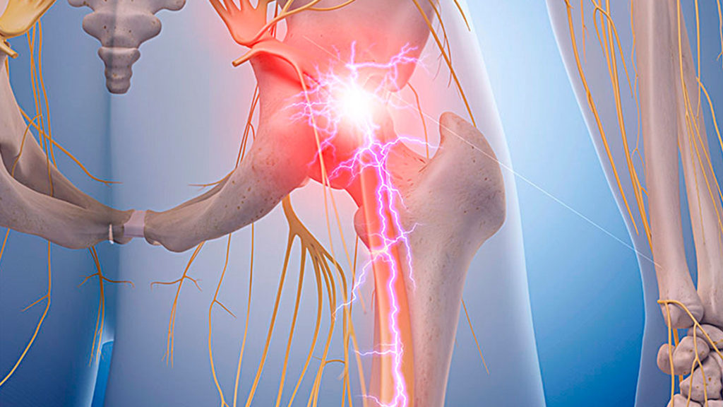 Anatomia do nervo ciático